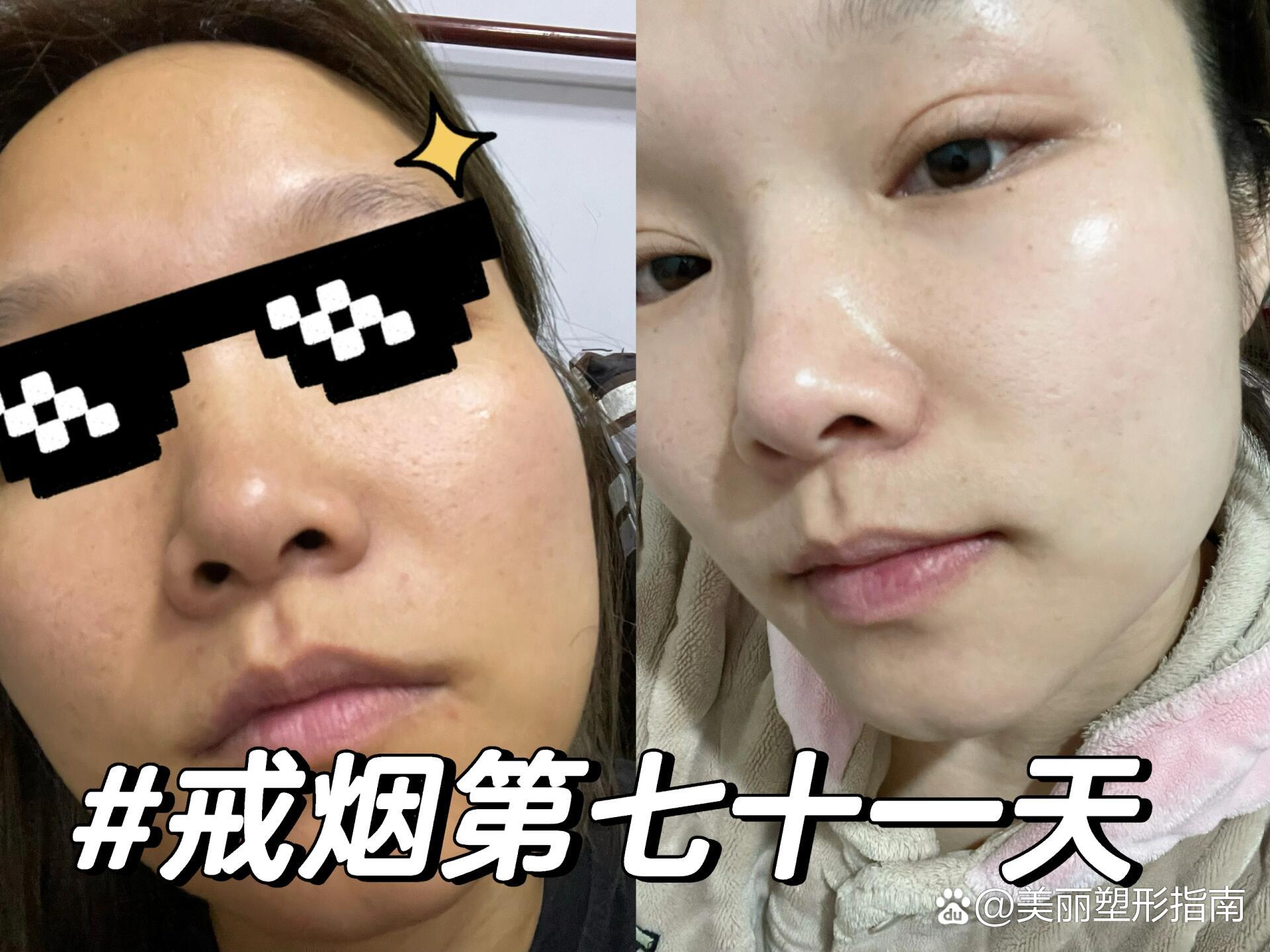 戒烟小目标苹果版戒烟小目标免费追剧电脑在线看
